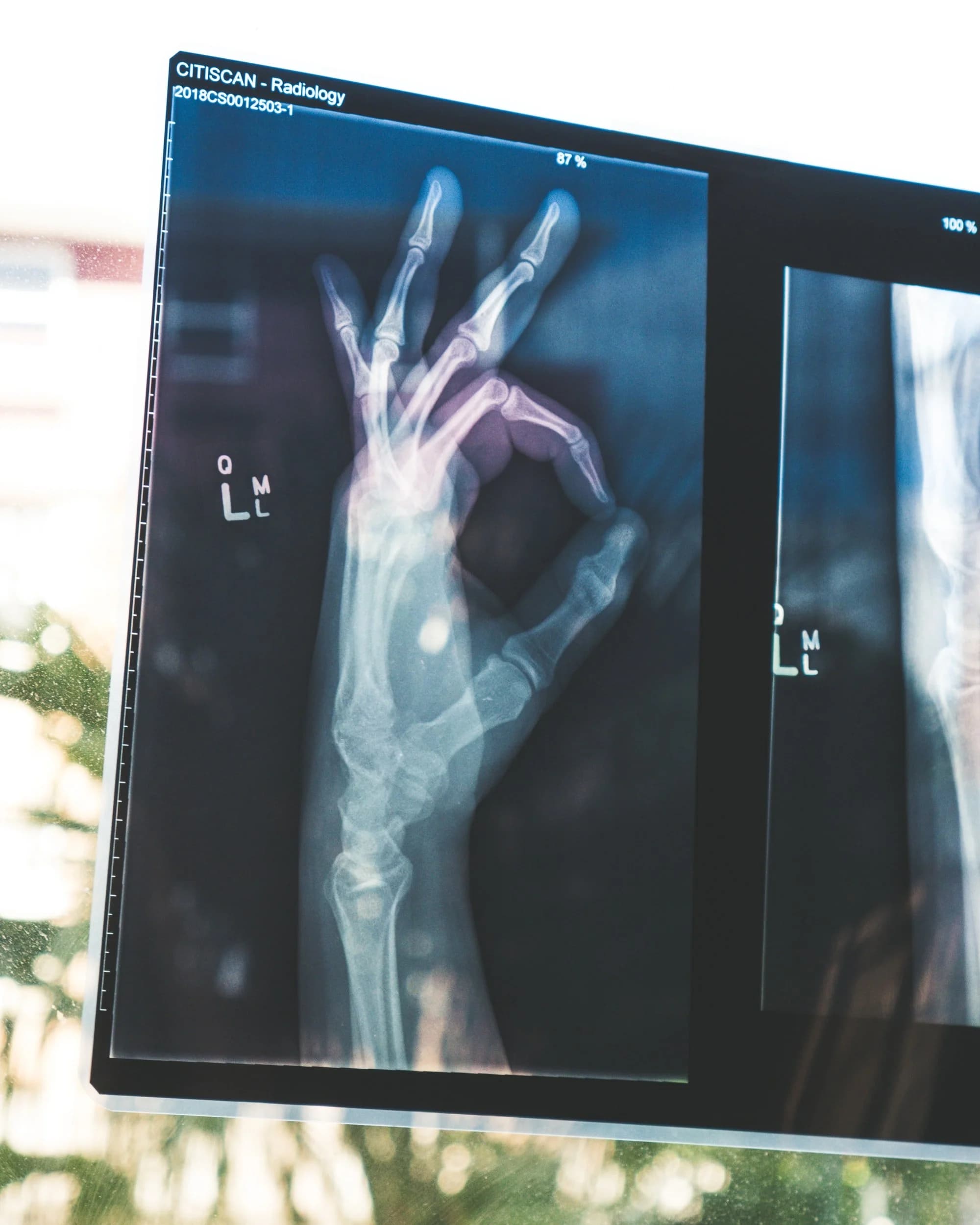 Header image for 'BFR and Bone Health: Muscle and Bone Interconnectivity'